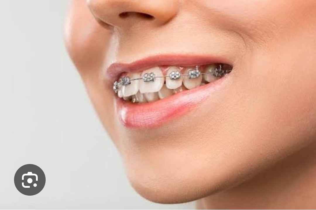 Lapel pins of tooth with braces